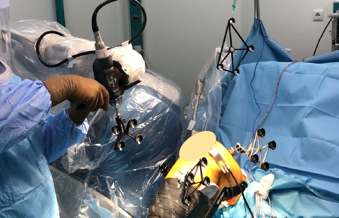 Resim 3: Robotik gözlerin yerleştirilmesi.