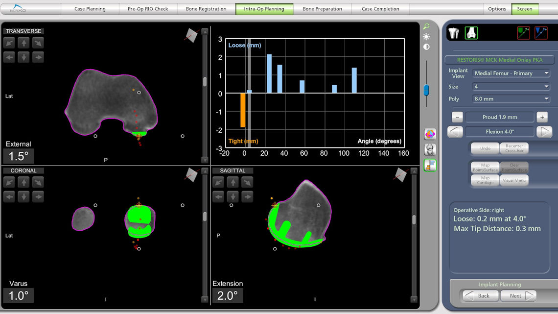 Resim 5: Dizin değişik hareket açılarında bağ dengesinin ölçülmesi.