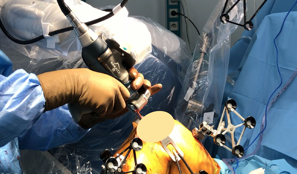 Resim 6: Robotik kol yardımı ile kesilerin yapılması.