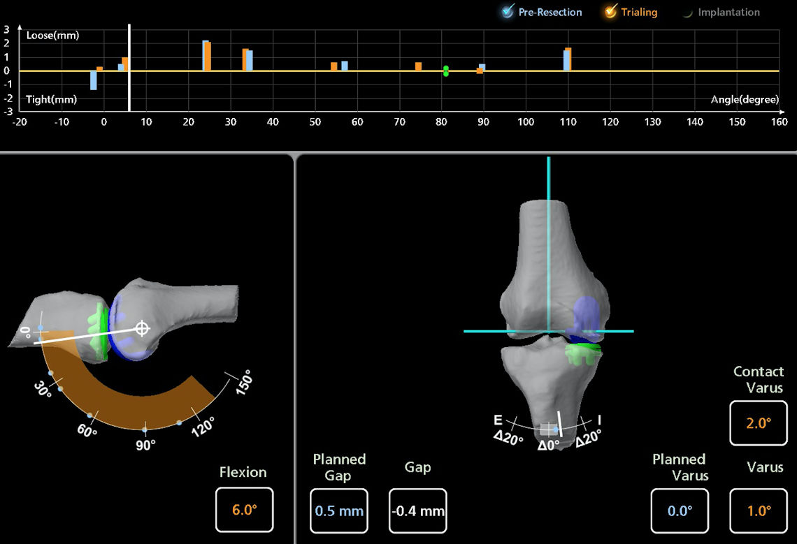 Resim 8: Protez parçaları yerleştirildikten sonra yapılan son bağ dengesi kontrolü.