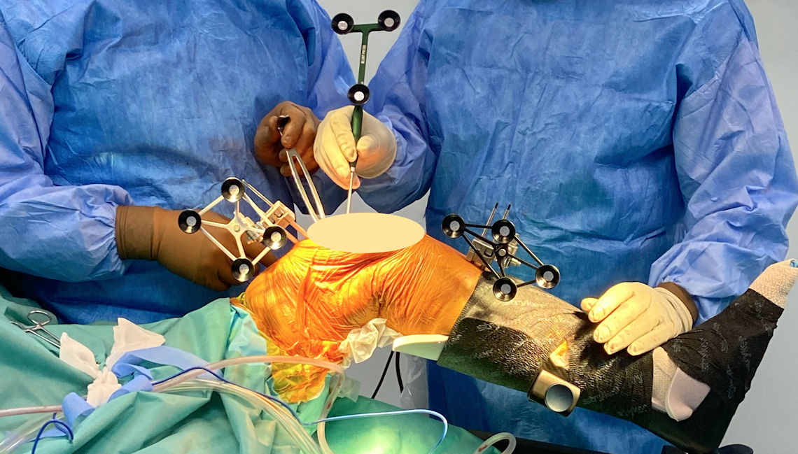 Resim 2: Elektronik gözler diz çevresi kemiklere uygulanmış.